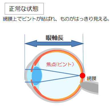 正常な目の断面図