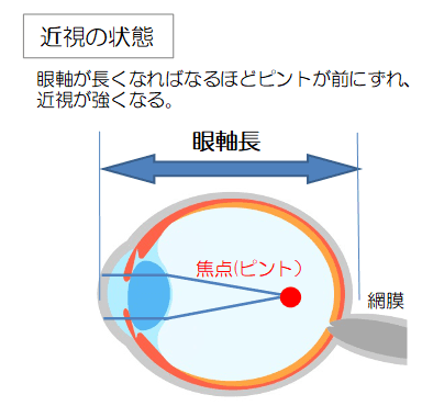 禁止の状態の目の断面図